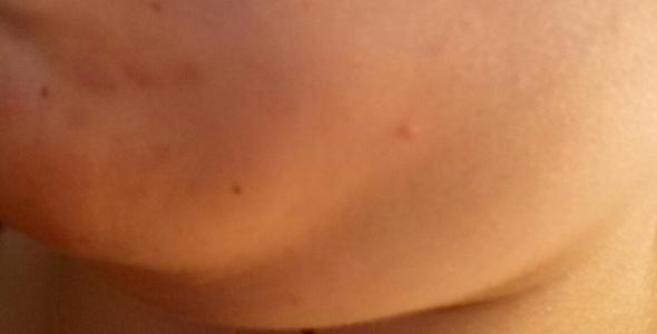 Kann Man In 2 en Ein Doppelkinn Wegkriegen Hilfe Junge