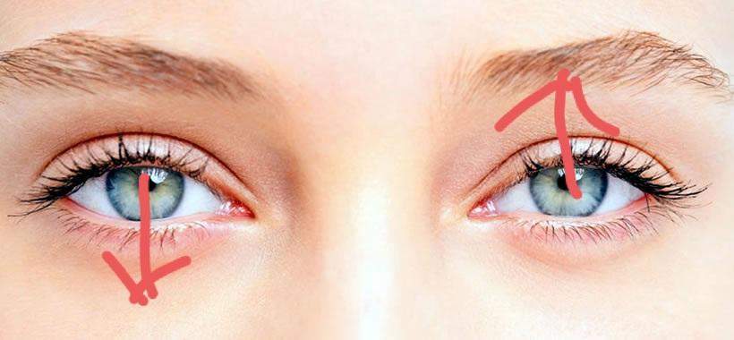 Kann man mit einem Auge nach oben und dem Anderen nach unten sehen