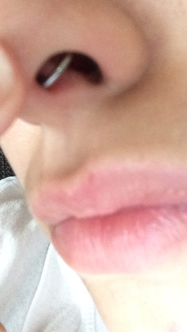 Kann Mein Septum Herauswachsen Piercing