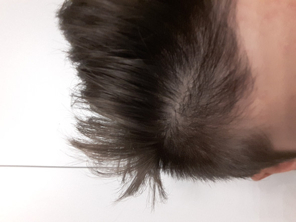 meine haare nicht stylen wegen wirbel