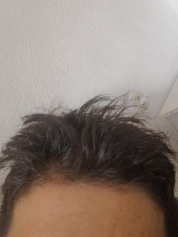 Kann mir bitte jemand helfen ich will die fettige haare los werden?