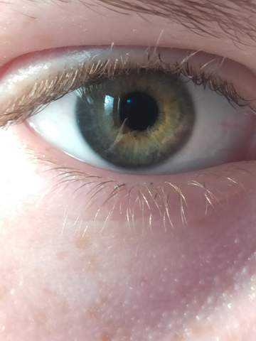Kann mir irgendjemand bitte sagen, welche Augenfarbe das ist?