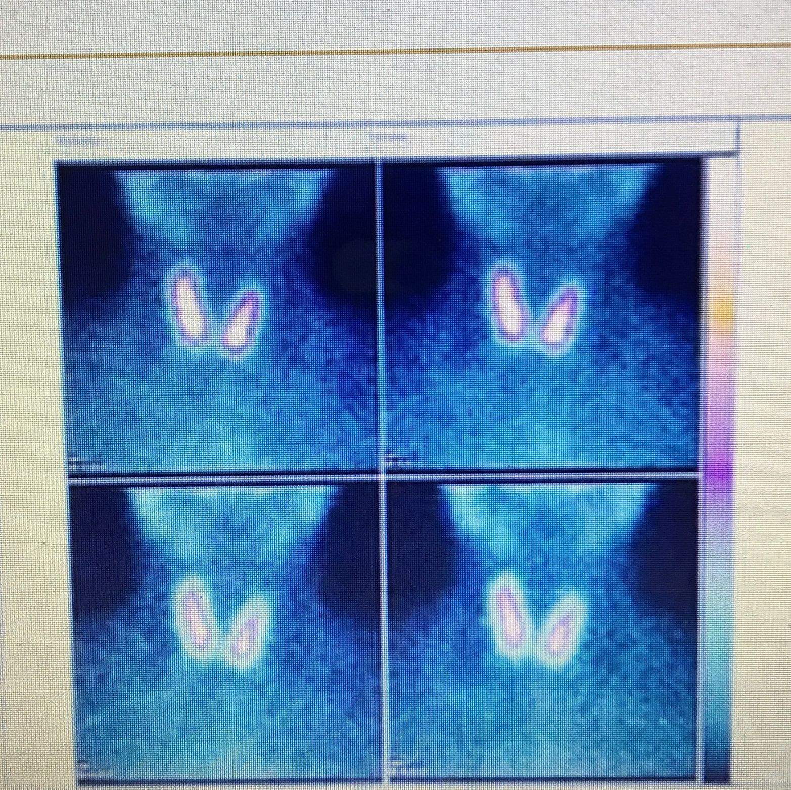 Kann mir jemand erklären was auf