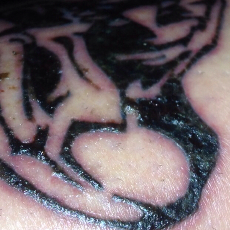 Kann mir jemand sagen ob das normal ist?! (Schmerzen, Tattoo, Entzündung)