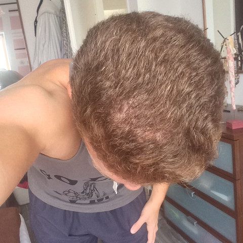 meinem haar bildet