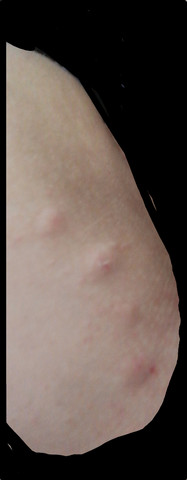 - (Gesundheit, Gesundheit und Medizin, Medizin)