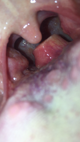 Kann mit mal einer sagen was das an mein kehldeckel ist? (Gesundheit