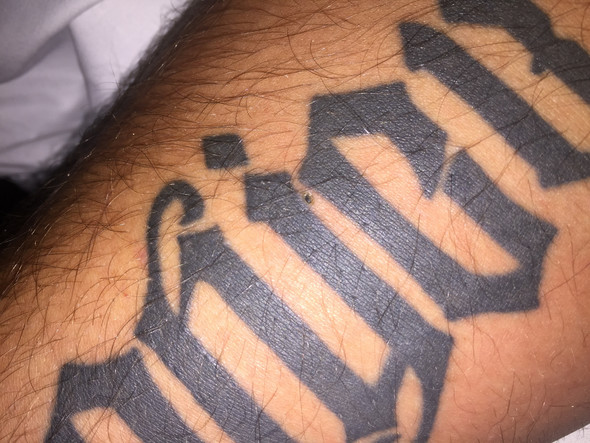 Kann Tattoo Farbe wandern bei Insektenstich? (Gesundheit und Medizin