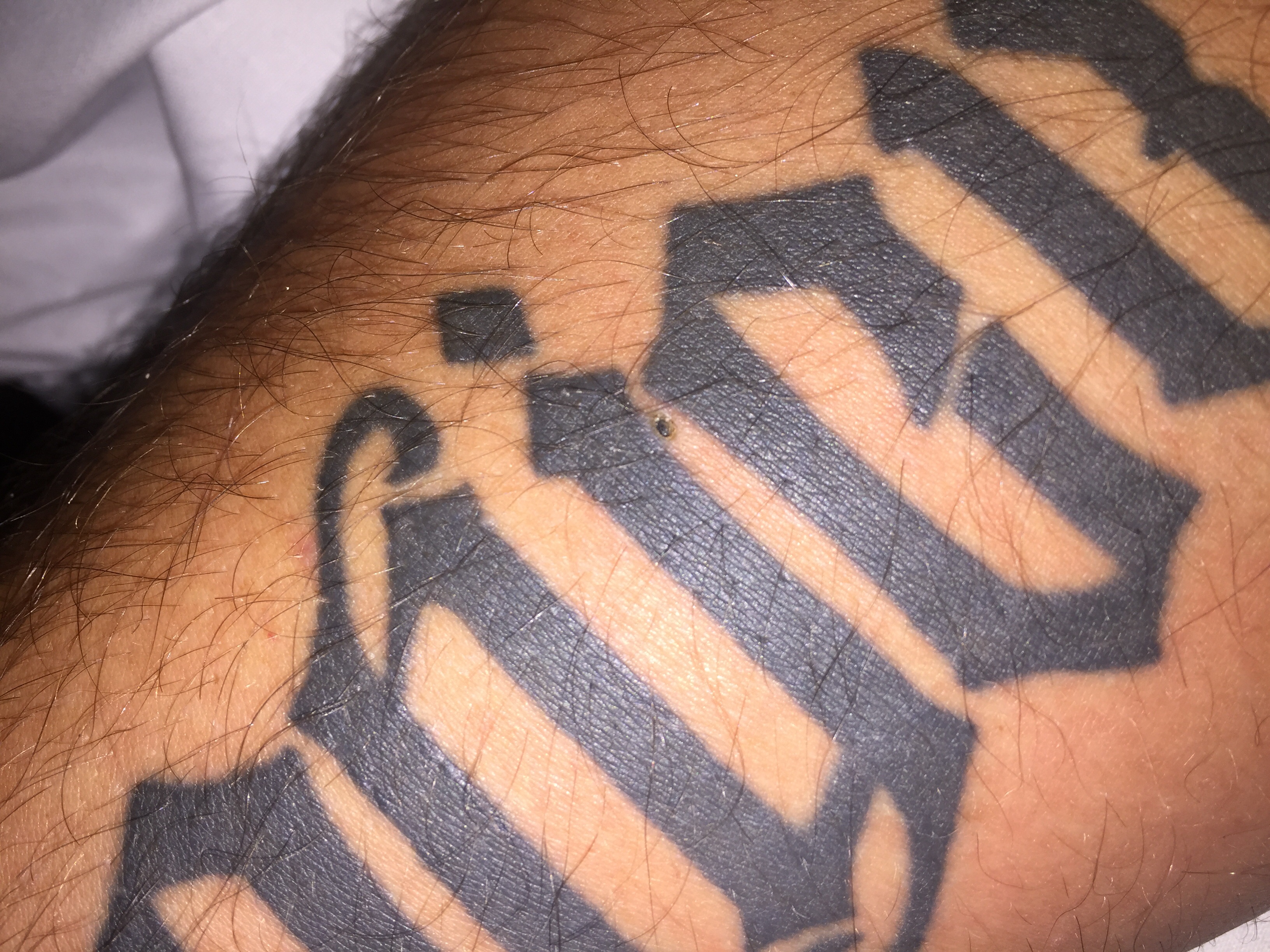 Kann Tattoo Farbe wandern bei Insektenstich? (Gesundheit und Medizin