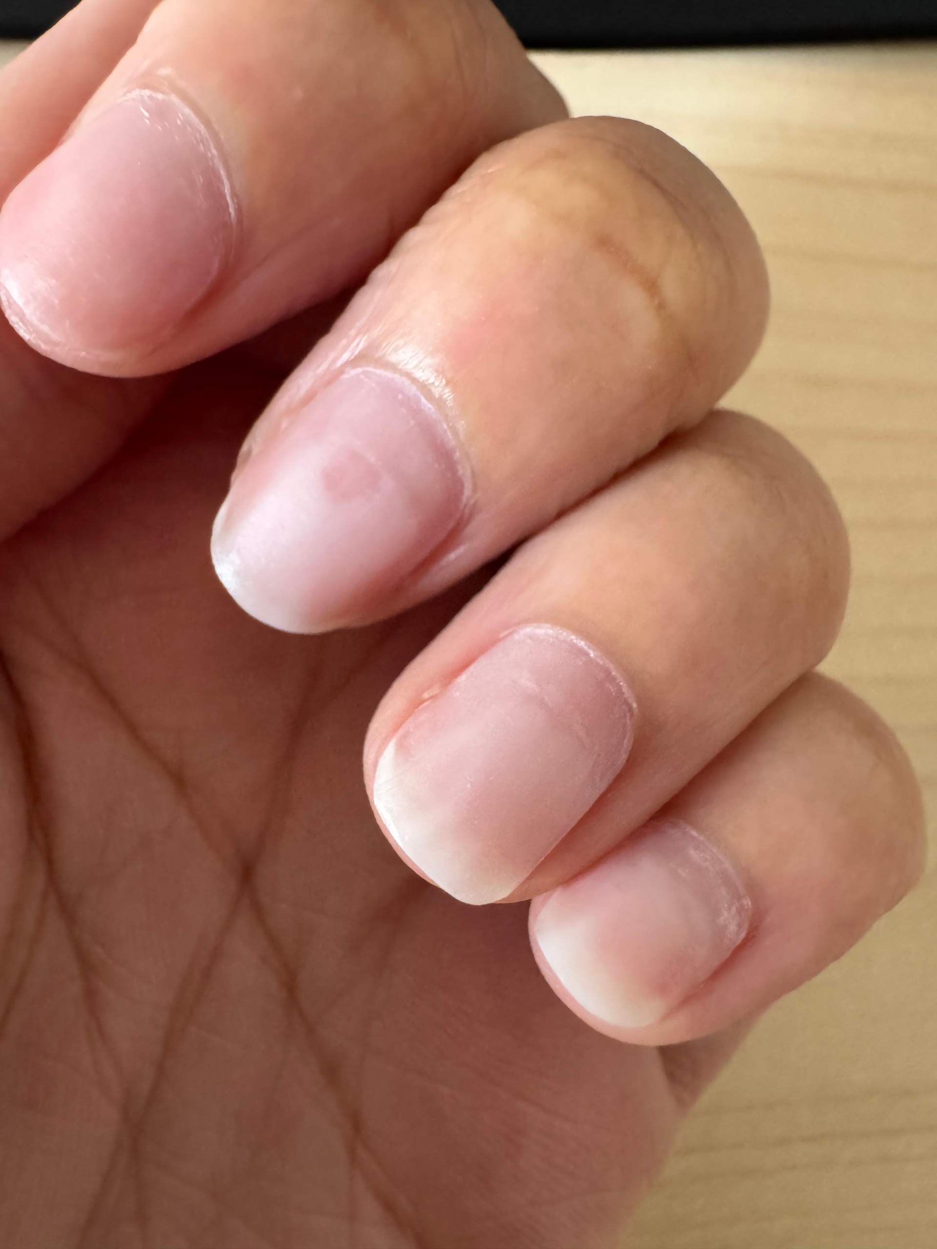 Kaputte Ngel nach Gel? (Pflege, Hand, Finger)
