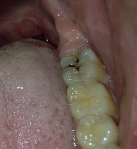Zähne  - (Zähne, Zahnarzt, Zahnmedizin)