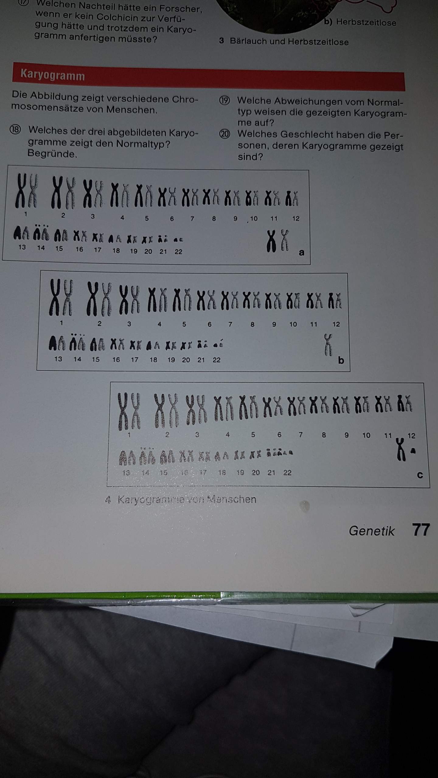 Karyogramm Auswerten Schule Studium Biologie 