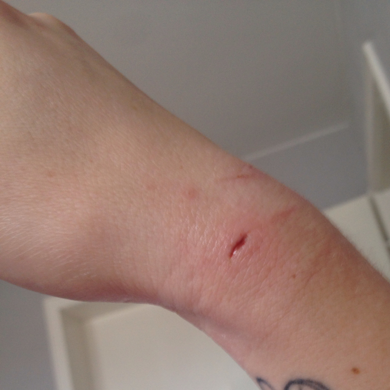 Katzenbiss, jetzt zum Doc? (Tiere, Arzt, Katze)