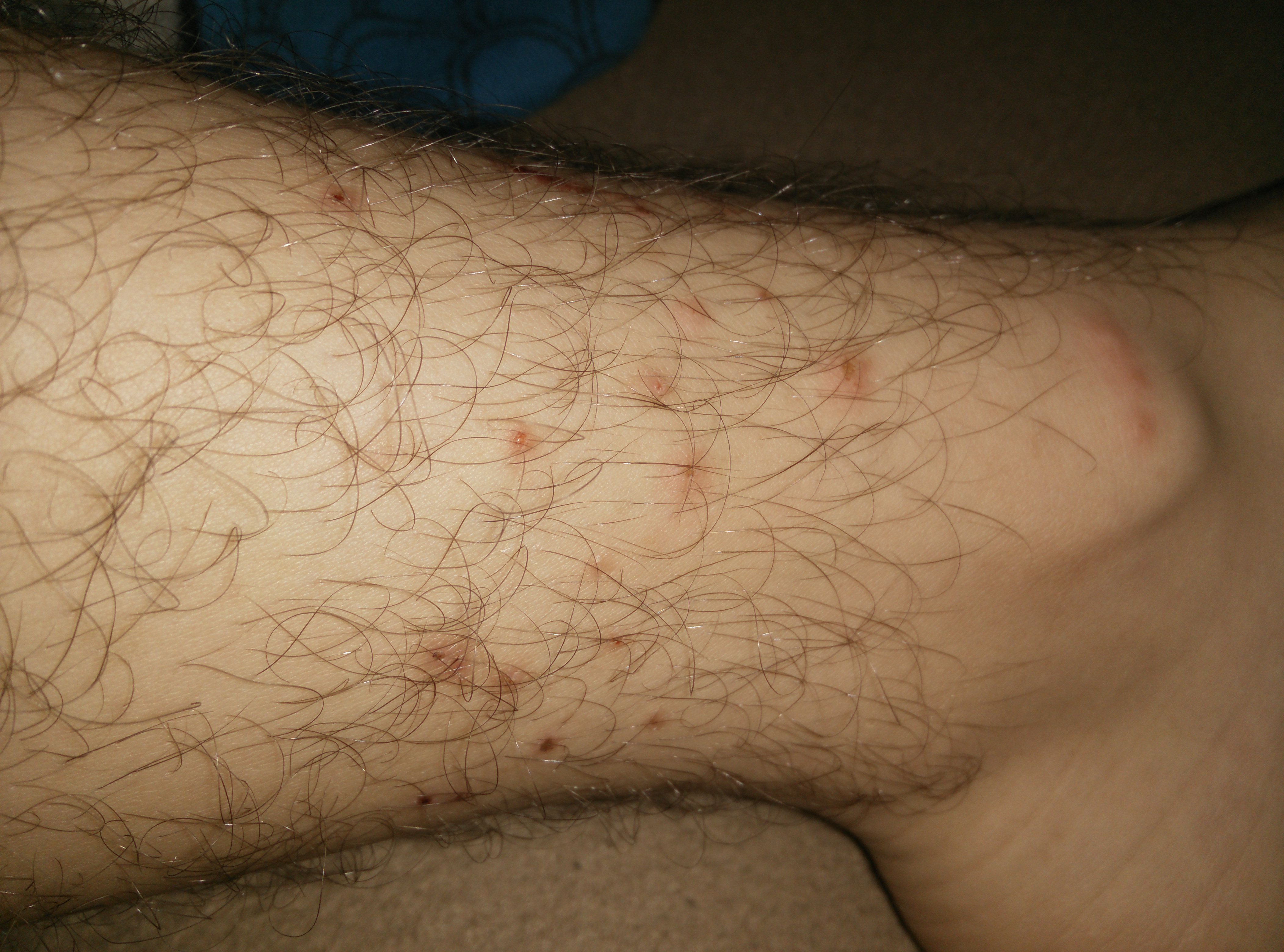 Katzenflöhe! Kann ich in die Schule? (Katze, Flöhe) Katzenflöhe! Kann ich in die Schule? (Katze, Flöhe)