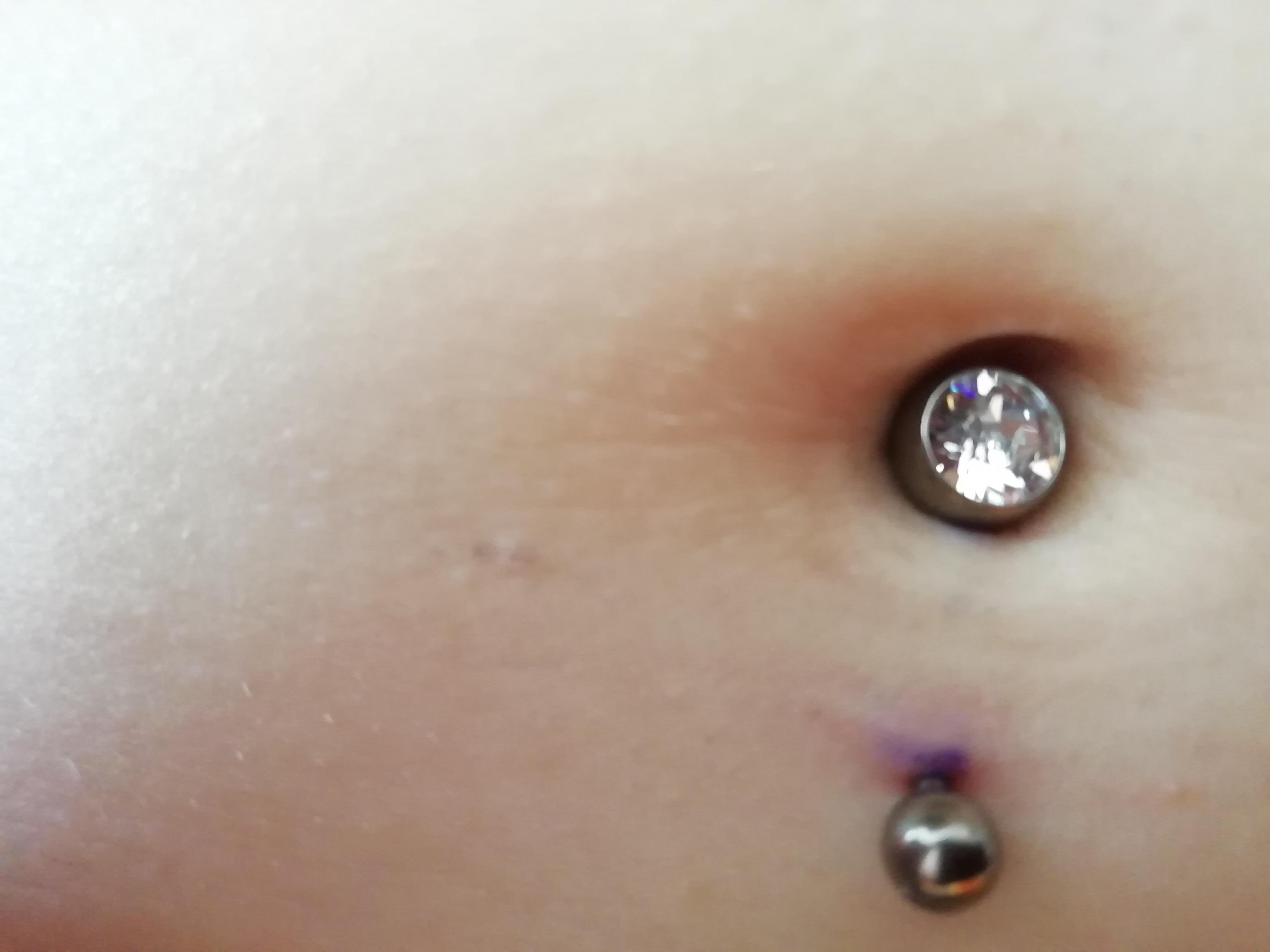 Was Tun Gegen Wildfleisch Am Bauchnabelpiercing