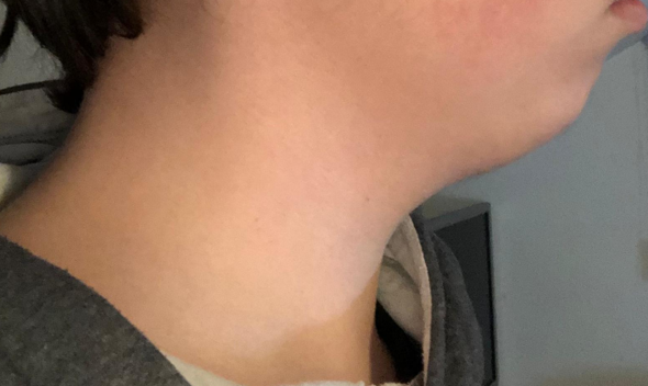 Kein Kinn Kann Man Es Ohne Op Verbessern Gesundheit Und Medizin Frauen Korper