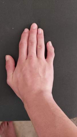 Kennt Ihr Sportler Die Auch Solche Finger Haben Gesundheit Sport