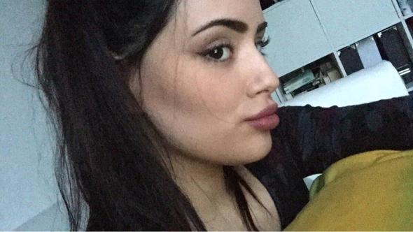 Kennt Ihr Vielleicht Die Kosten Und Risiken Einer Nasen Op Konnt Ihr Einen Chirurgen Empfehlen Gesundheit Korper Schonheit