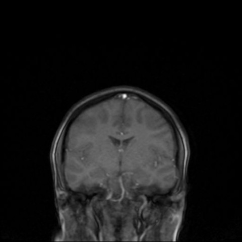 Bild 3 - (Gesundheit, Medizin, Körper)