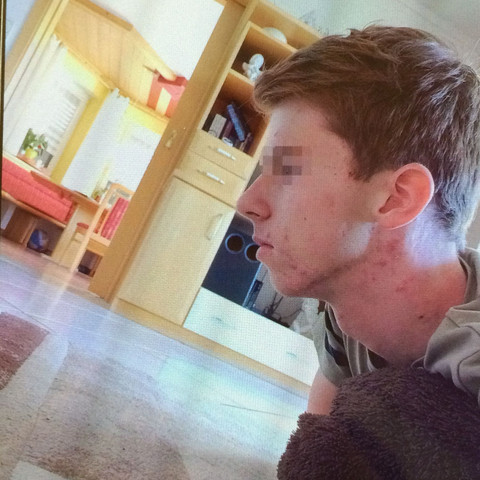 Kinn Op Kosten Mann Arzt Beauty Aussehen