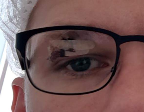 Klammerpflaster Hat Sich Uber Nacht Mit Blut Vollgesaugt Trotzdem Dran Lassen Gesundheit Und Medizin Platzwunde Klammerpflaster Hat Sich Uber Nacht Mit Blut Vollgesaugt Trotzdem Dran Lassen Gesundheit Und Medizin Platzwunde