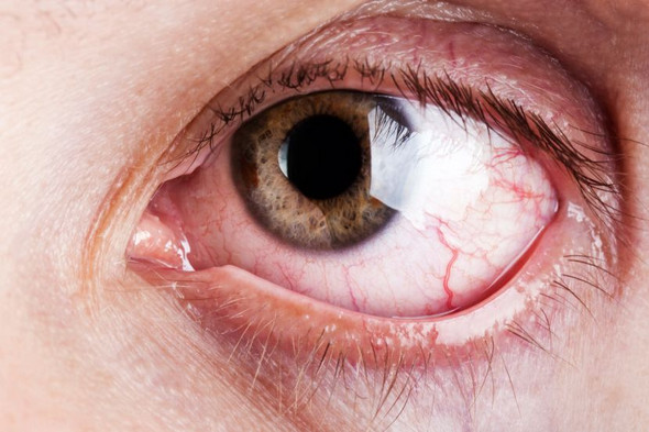 Kleine Faden Im Auge Gesundheit Und Medizin Augen Eklig Kleine Faden Im Auge Gesundheit Und Medizin Augen Eklig