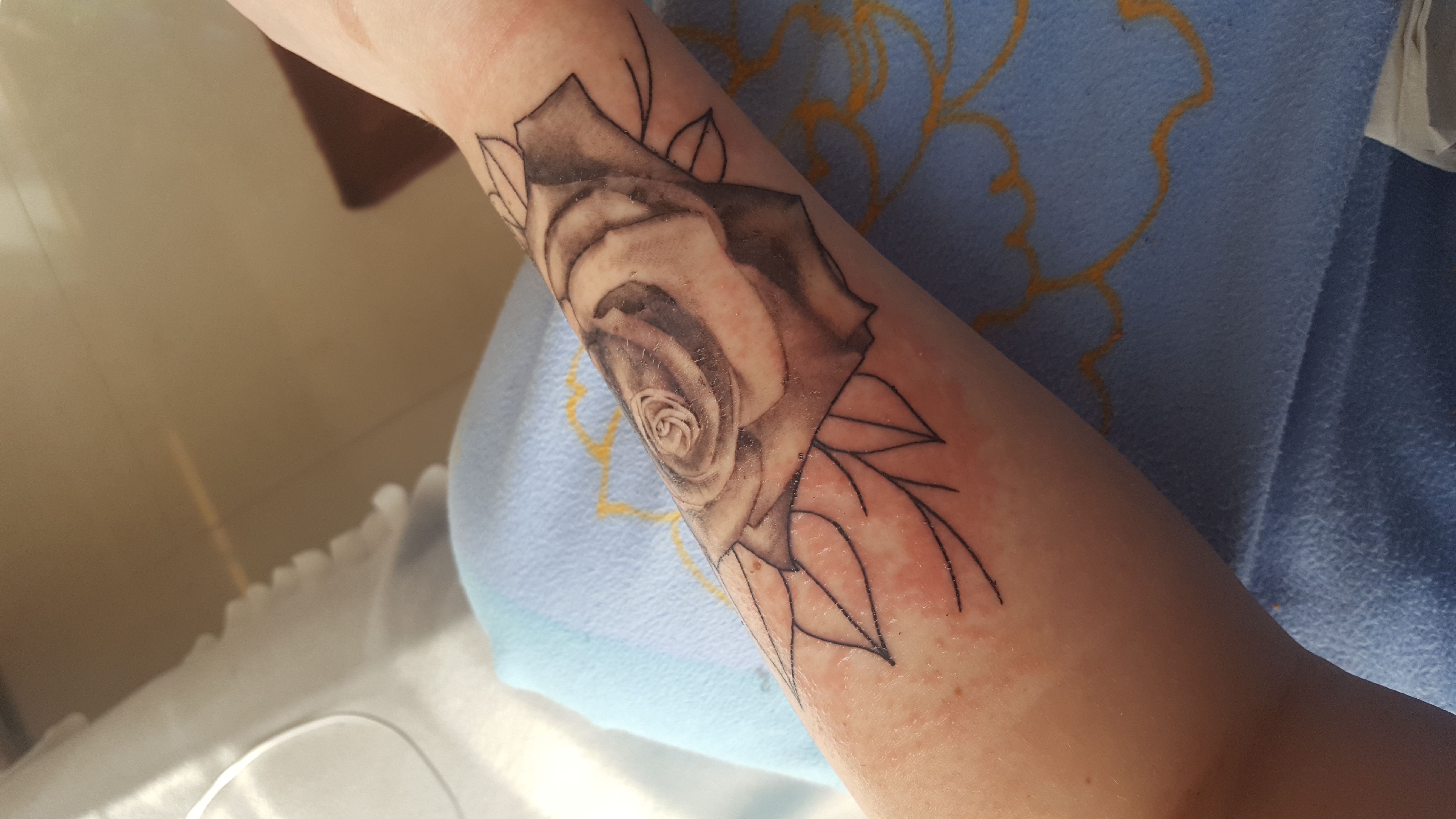 Kleine Pickel Rund Ums Tattoo Hilfe Ausschlag