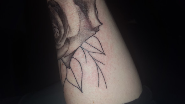 Kleine Pickel Rund Ums Tattoo Hilfe Ausschlag