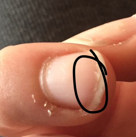 Kleine Risse Im Nagel Nagel Nagelpflege