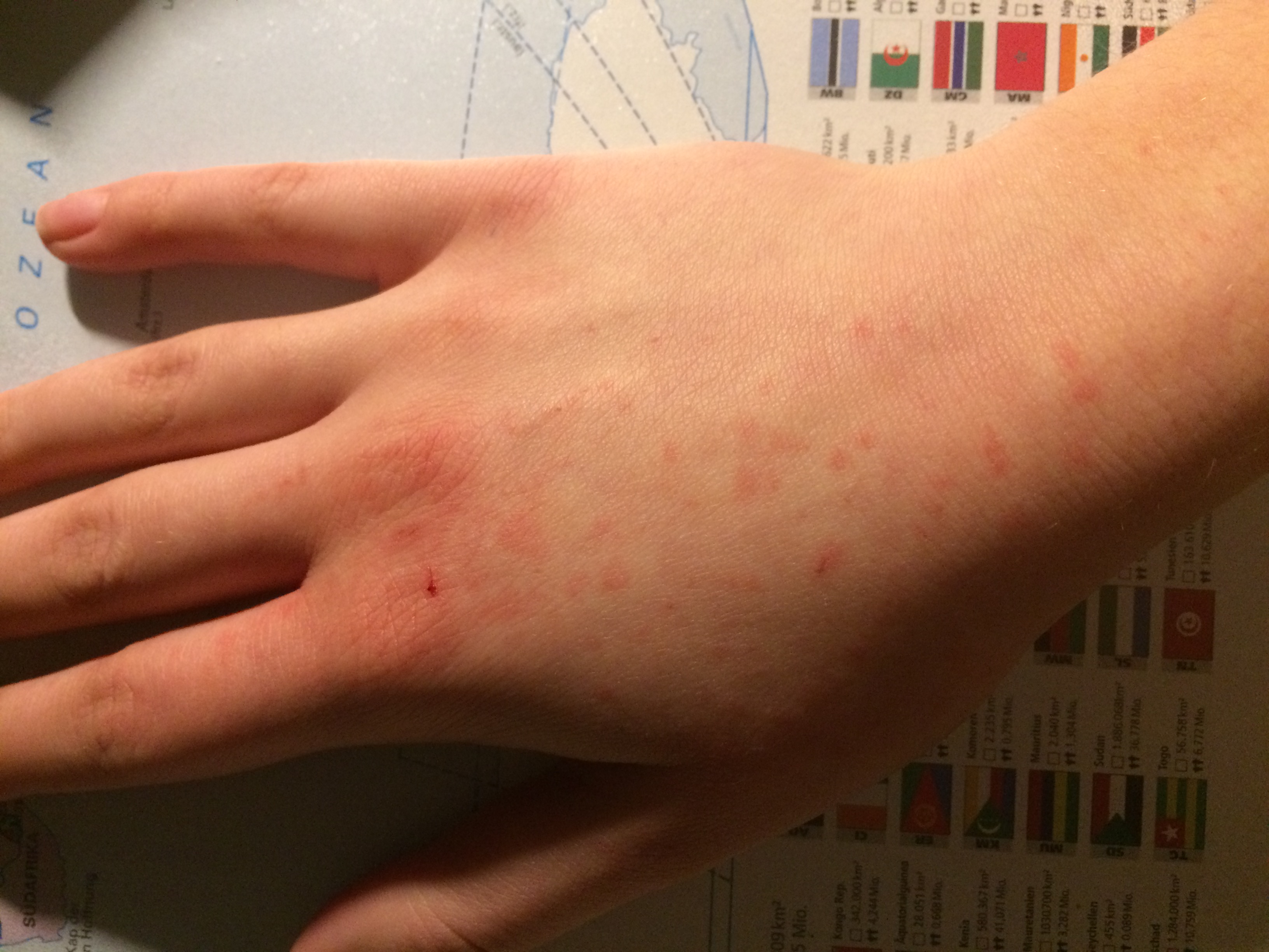 Kleine Risse in Hand? (Gesundheit, Medizin)