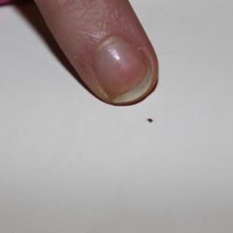 Kleine Rote Spinnen Wir Sind Im Garten