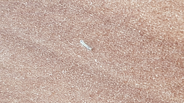 - (Insekten, Ungeziefer)