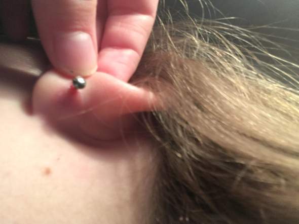 Kleine Wunde Am Ohrloch Gesundheit Und Medizin Piercing Kleine Wunde Am Ohrloch Gesundheit Und Medizin Piercing