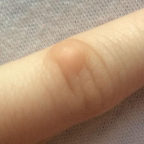 Das ist mein kleiner Finger - (Link, Hand, Hornhaut)
