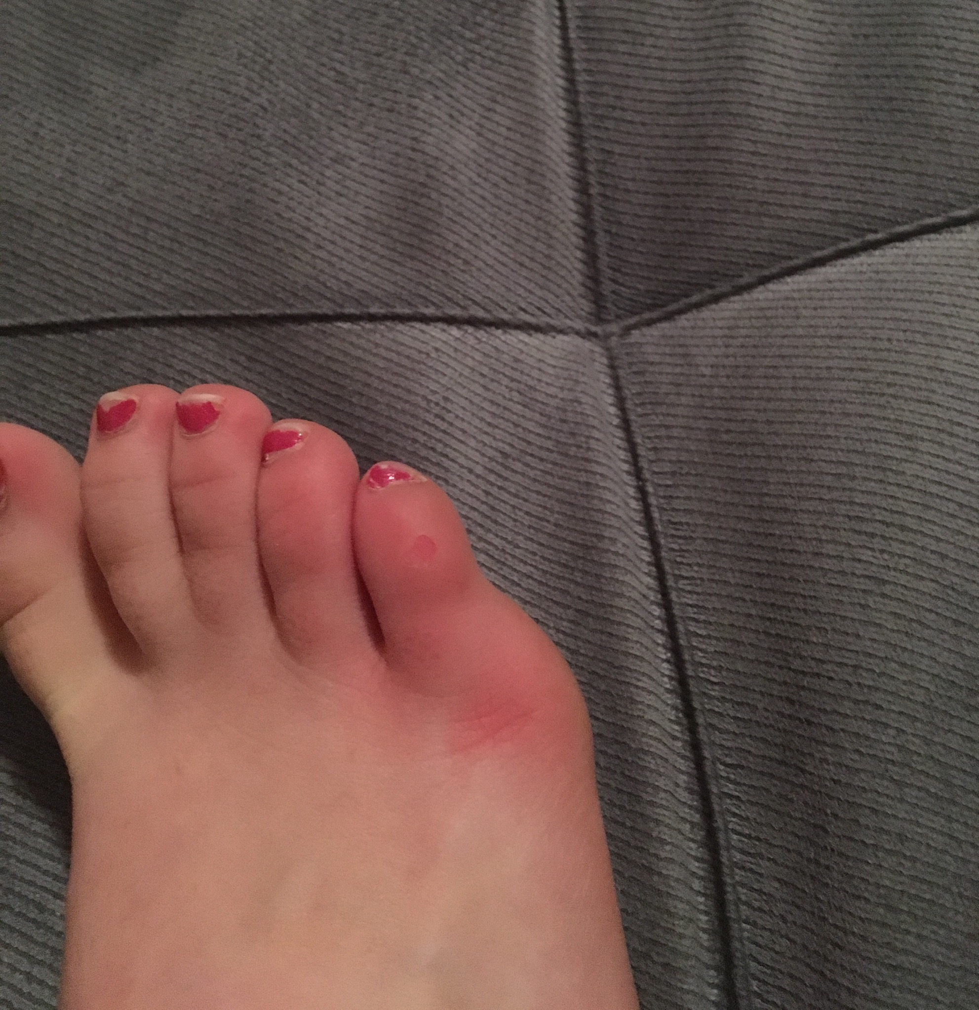 Kleiner Zeh Tapen Anleitung Buddytaping