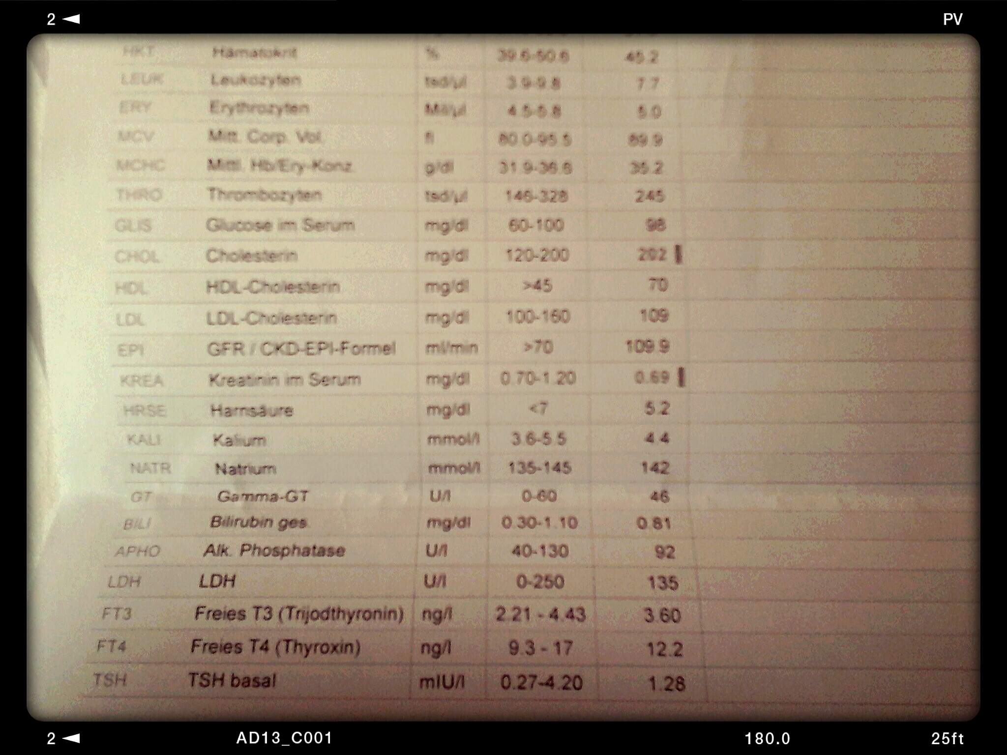 Kleines Blutbild enthält Auffälligkeiten? (Gesundheit, Medizin,