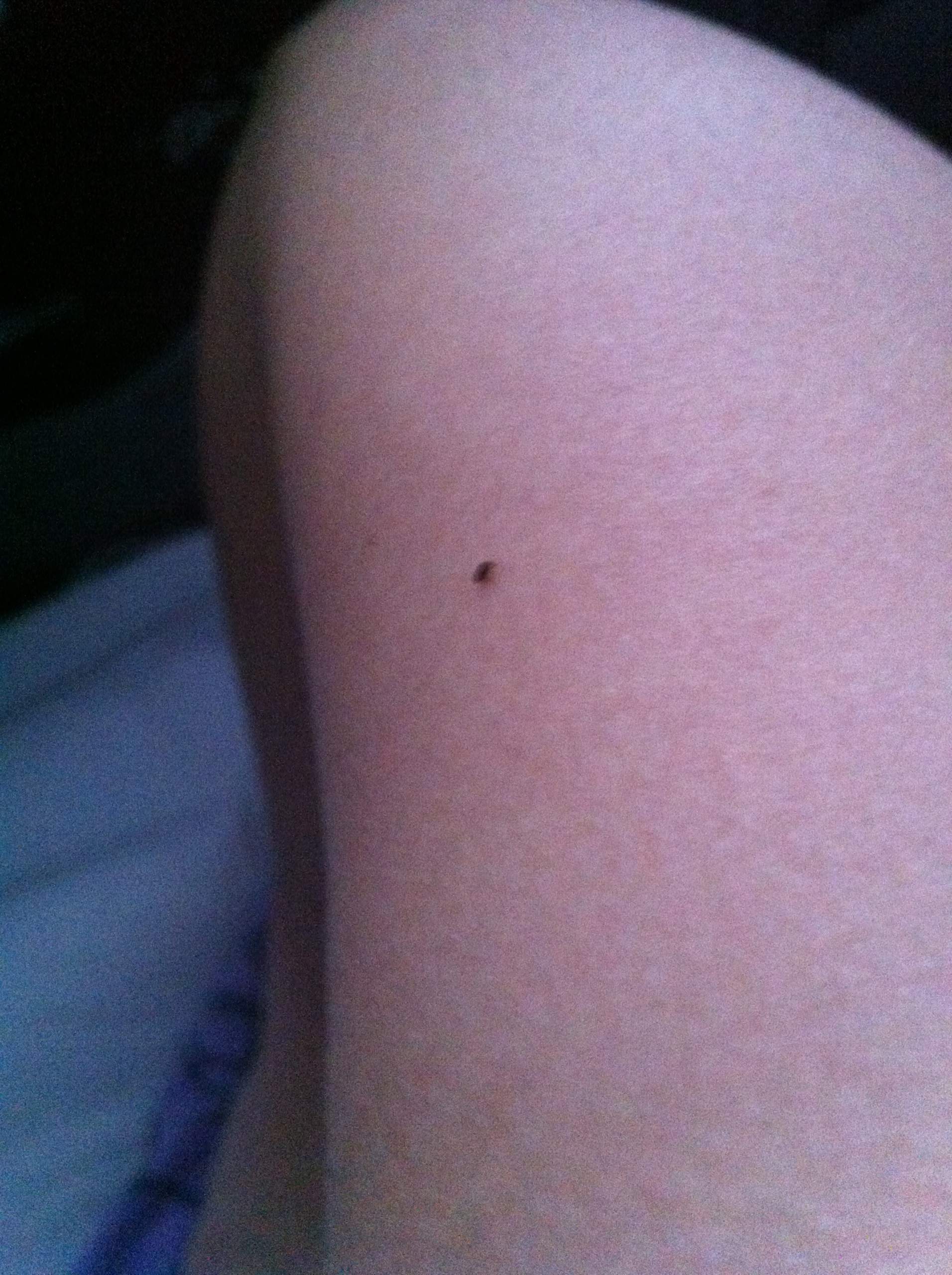 Kleine,schwarze Käfer im bett! (Gesundheit, Tiere)