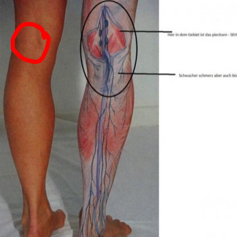 Knie Hinten Blau Gesundheit Und Medizin Medizin Arzt Knie Hinten Blau Gesundheit Und Medizin Medizin Arzt