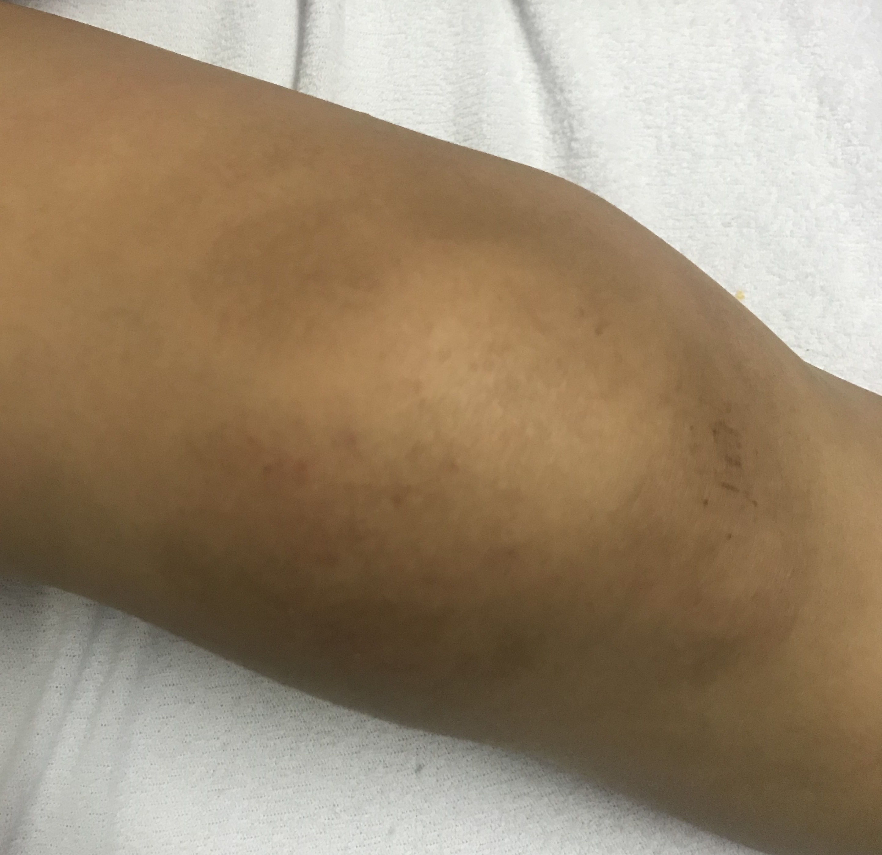 Knie Tut Weh Wegen Sturz Was Kann Es Sein Knieschmerzen Artz Kniescheibe Knie Tut Weh Wegen Sturz Was Kann Es Sein Knieschmerzen Artz Kniescheibe