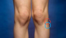 Knieschmerzen Aber Warum Gesundheit Knie Knieschmerzen Aber Warum Gesundheit Knie