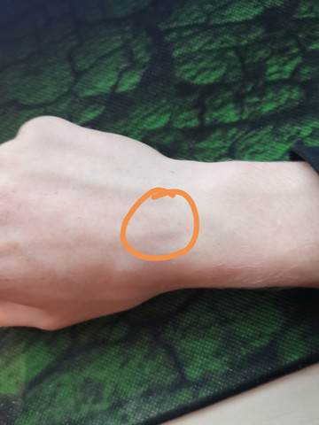 Knochen An Handgelenk Medizin Arzt Schmerzen Knochen An Handgelenk Medizin Arzt Schmerzen