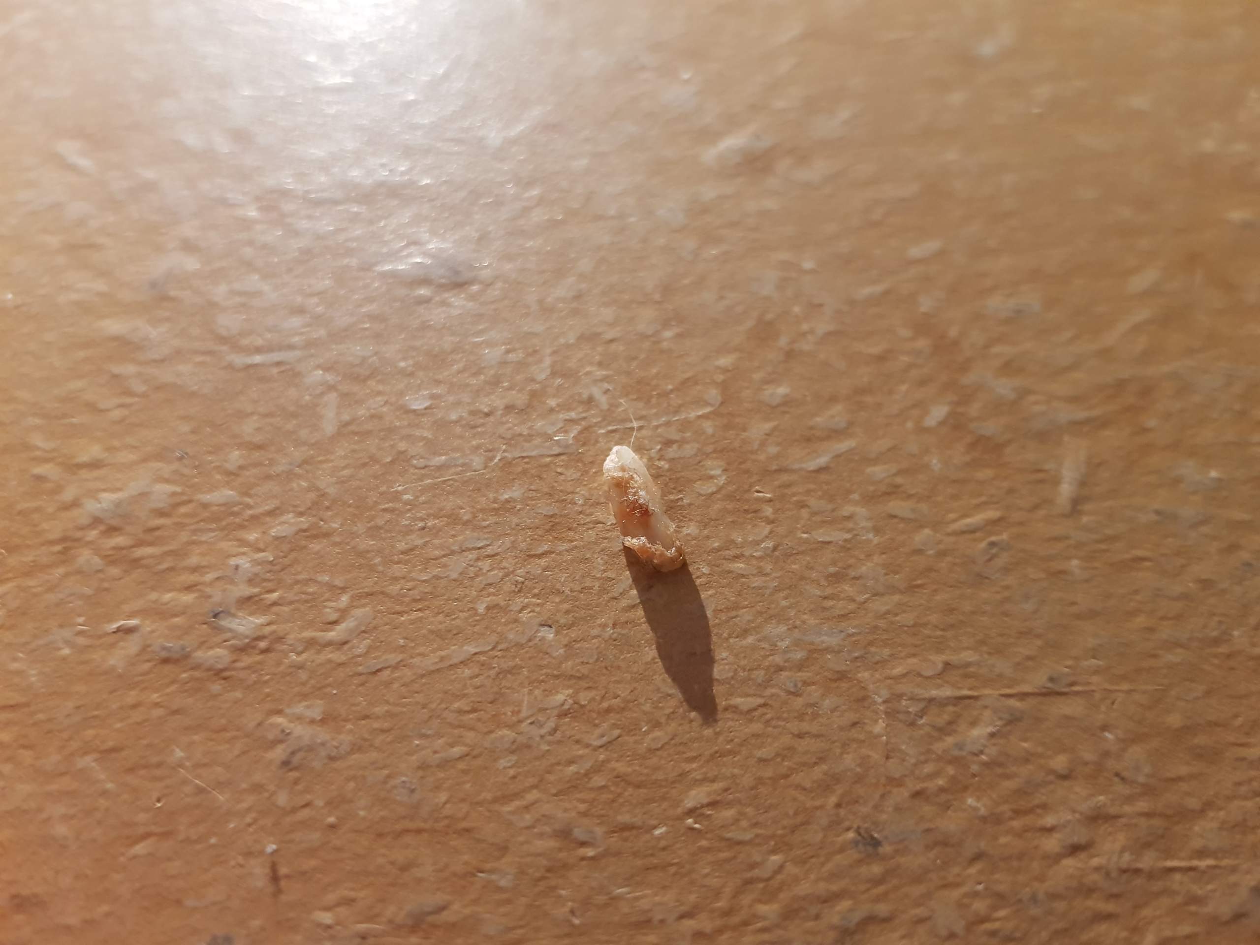 Knochensplitter im Hamburger? (Essen, Fleisch)