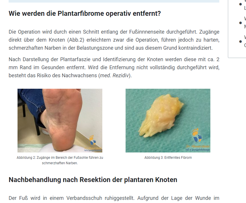 Knoten auf Fußsohle? (Gesundheit und Medizin, Gesundheit, Füße)