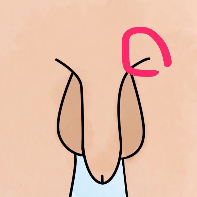 Knoten Neben Penisansatz Krankheit Penis Ansatz Knoten Neben Penisansatz Krankheit Penis Ansatz
