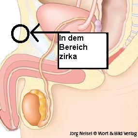 Knoten Oder Pickel Am Schambein Schmerzen Schambereich