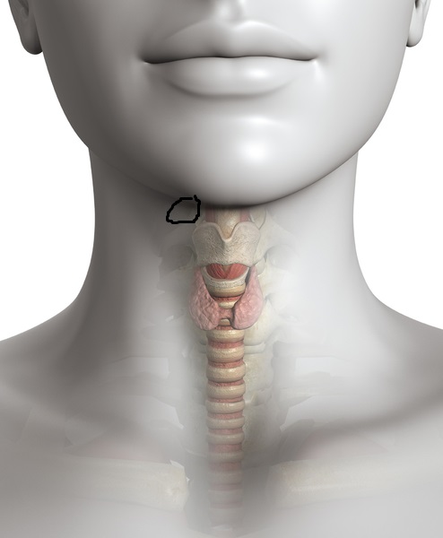 Knoten Uber Dem Kehlkopf Krebs Hals Tumor Knoten Uber Dem Kehlkopf Krebs Hals Tumor