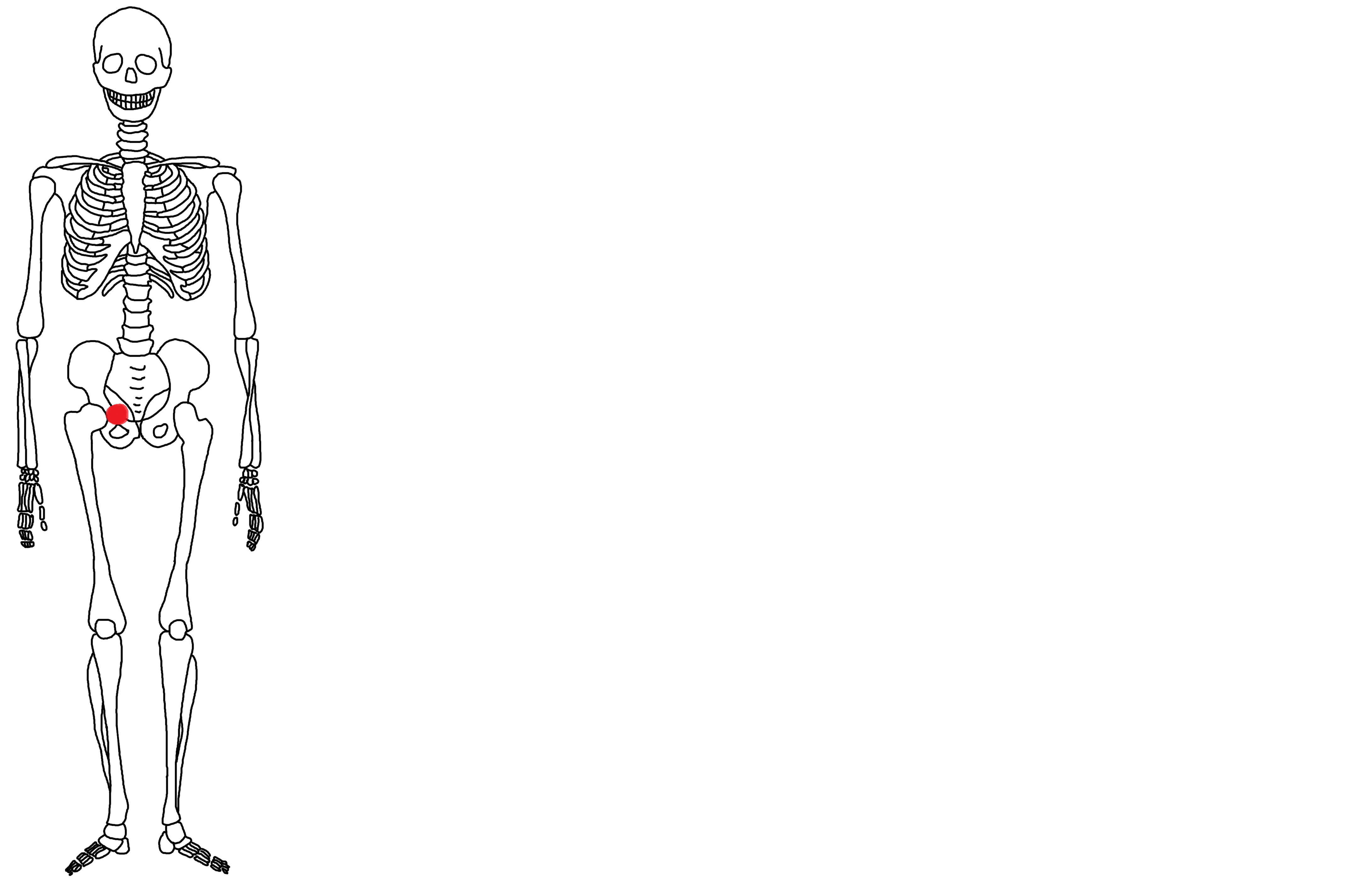 Knoten unter der Haut gefühlt, was ist das? (Schmerzen, Krebs)