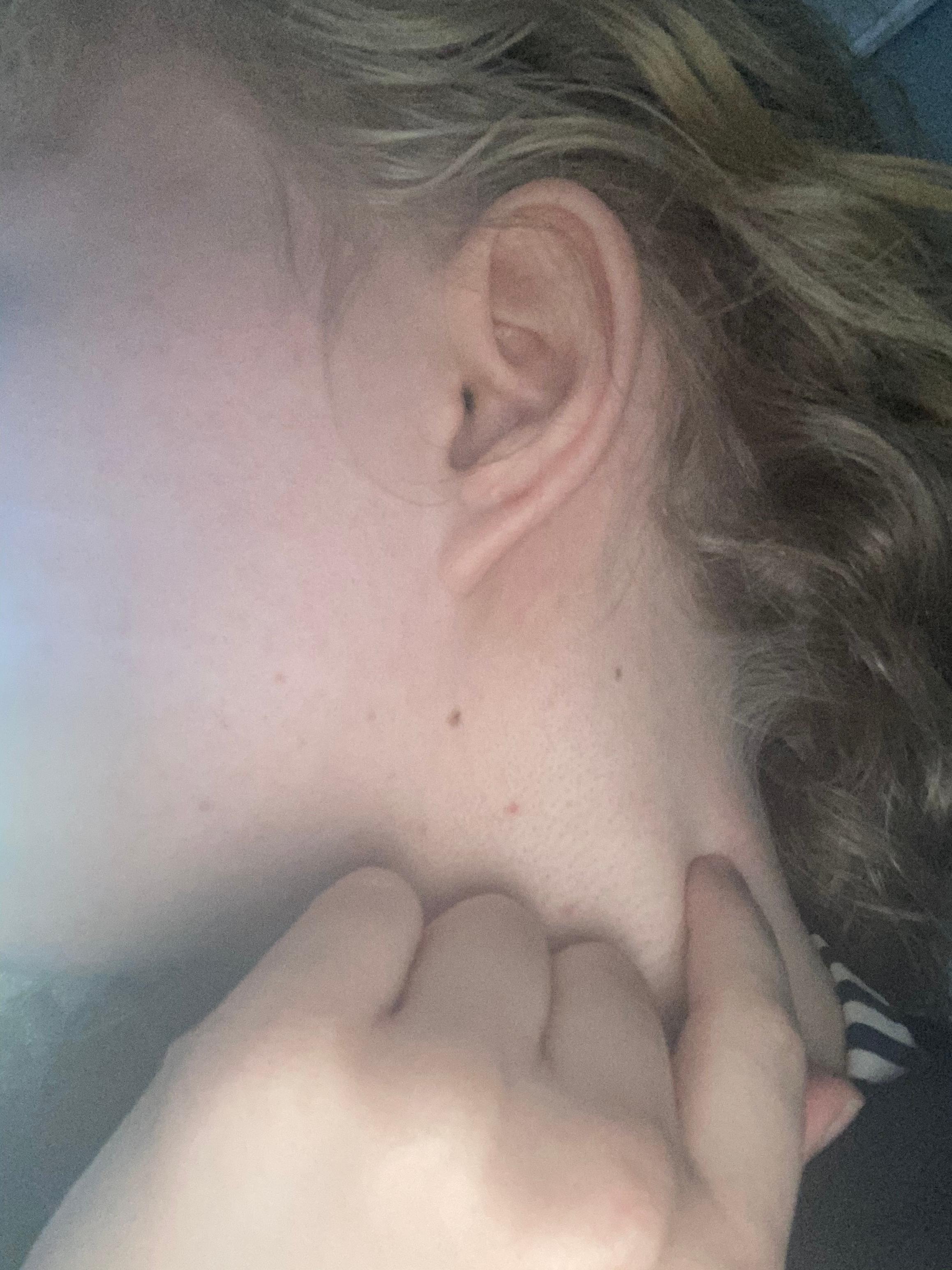 Knubbel Hals Gesundheit Und Medizin Halsschlagader Knubbel Hals Gesundheit Und Medizin Halsschlagader