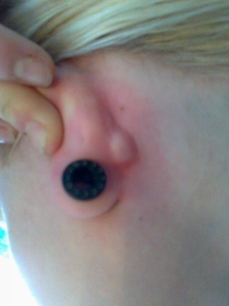 View Pickel Im Ohr Ausdrücken Images