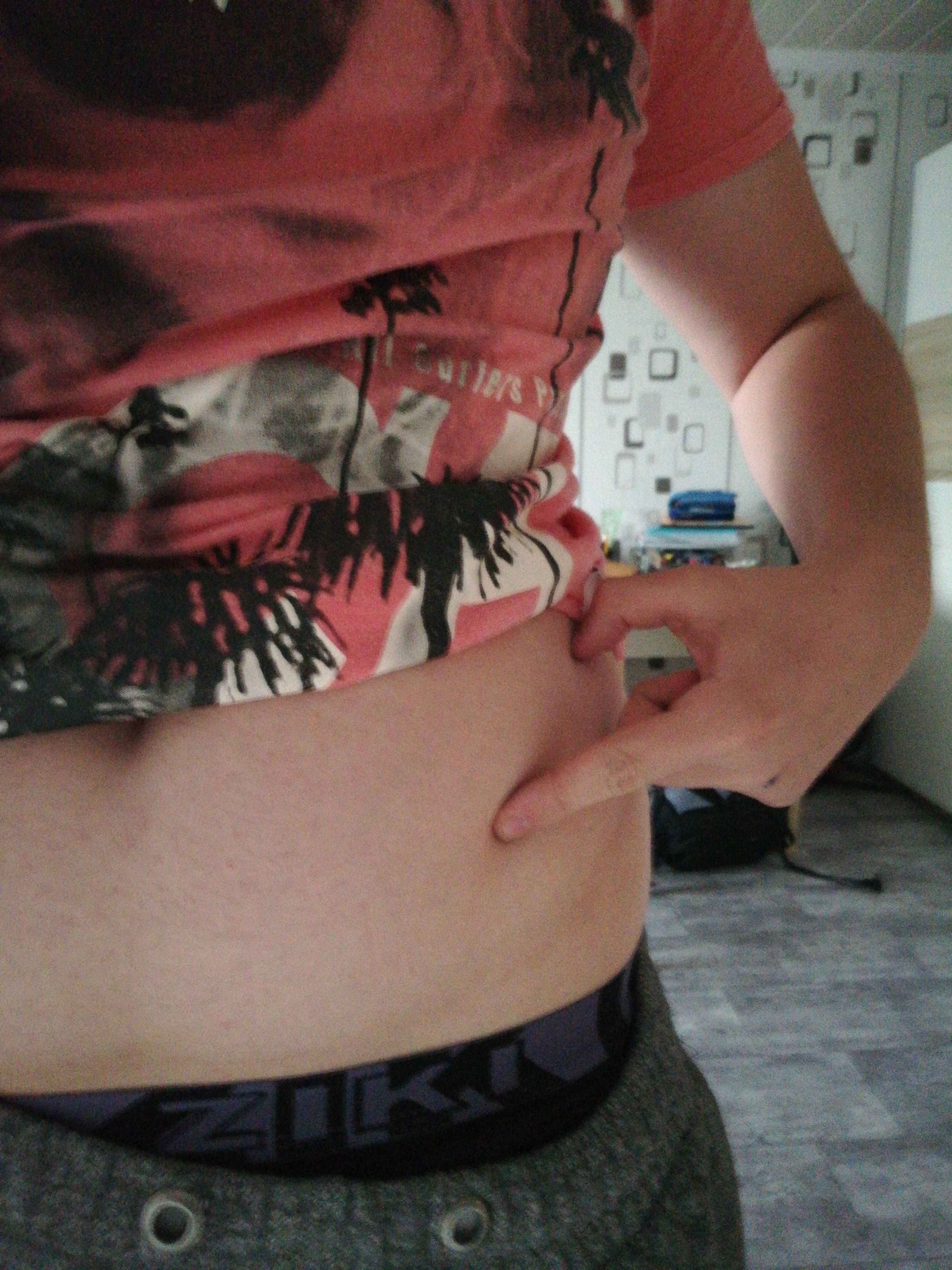 Knubbel Im Bauch Was Kann Das Sein Gesundheit Und Medizin Knoten Lipom Knubbel Im Bauch Was Kann Das Sein Gesundheit Und Medizin Knoten Lipom